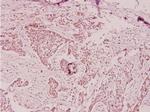 PTX3 Antibody in Immunohistochemistry (Paraffin) (IHC (P))