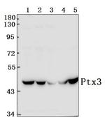 PTX3 Antibody in Western Blot (WB)