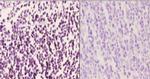 MEK6 Antibody in Immunohistochemistry (Paraffin) (IHC (P))