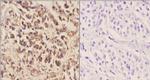 MEK6 Antibody in Immunohistochemistry (Paraffin) (IHC (P))