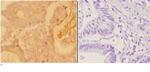 ADARB1 Antibody in Immunohistochemistry (Paraffin) (IHC (P))