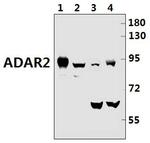 ADARB1 Antibody in Western Blot (WB)