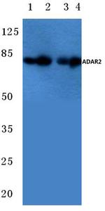 ADARB1 Antibody in Western Blot (WB)