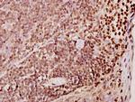 TDE1 Antibody in Immunohistochemistry (Paraffin) (IHC (P))