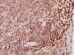 TDE1 Antibody in Immunohistochemistry (Paraffin) (IHC (P))