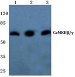 CaMKII beta/gamma Antibody in Western Blot (WB)