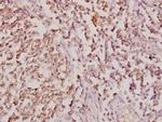 COL11A1 Antibody in Immunohistochemistry (Paraffin) (IHC (P))