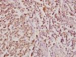 COL11A1 Antibody in Immunohistochemistry (Paraffin) (IHC (P))