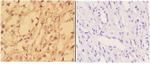 alpha Actinin 3 Antibody in Immunohistochemistry (Paraffin) (IHC (P))