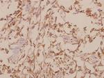 GTF2H1 Antibody in Immunohistochemistry (Paraffin) (IHC (P))