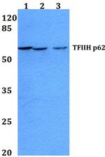 GTF2H1 Antibody in Western Blot (WB)