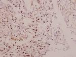 IRX1 Antibody in Immunohistochemistry (Paraffin) (IHC (P))