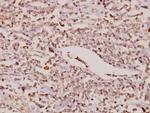 FOXC1/FOXC2 Antibody in Immunohistochemistry (Paraffin) (IHC (P))