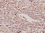 FOXC1/FOXC2 Antibody in Immunohistochemistry (Paraffin) (IHC (P))