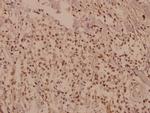 CUG-BP Antibody in Immunohistochemistry (Paraffin) (IHC (P))