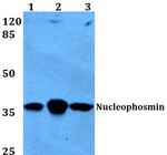 NPM1 Antibody in Western Blot (WB)