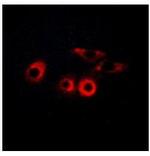 Laminin gamma-1 Antibody in Immunocytochemistry (ICC/IF)