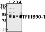 BRF1 Antibody in Western Blot (WB)