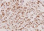 TACC3 Antibody in Immunohistochemistry (Paraffin) (IHC (P))