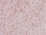 ZNF23 Antibody in Immunohistochemistry (Paraffin) (IHC (P))