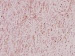 ZNF23 Antibody in Immunohistochemistry (Paraffin) (IHC (P))