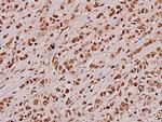 JIP3 Antibody in Immunohistochemistry (Paraffin) (IHC (P))