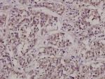 CTPS Antibody in Immunohistochemistry (Paraffin) (IHC (P))