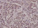 CTPS Antibody in Immunohistochemistry (Paraffin) (IHC (P))