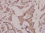 ACOT2 Antibody in Immunohistochemistry (Paraffin) (IHC (P))