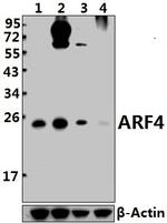 ARF4 Antibody in Western Blot (WB)