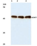 GCNT7 Antibody in Western Blot (WB)