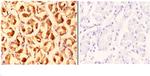 CLN6 Antibody in Immunohistochemistry (Paraffin) (IHC (P))