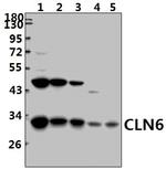 CLN6 Antibody in Western Blot (WB)