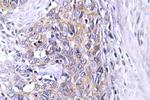 CLN6 Antibody in Immunohistochemistry (Paraffin) (IHC (P))