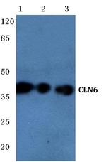 CLN6 Antibody in Western Blot (WB)