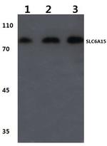 SLC6A15 Antibody in Western Blot (WB)