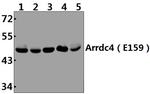 ARRDC4 Antibody in Western Blot (WB)