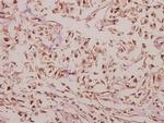 ARRDC4 Antibody in Immunohistochemistry (Paraffin) (IHC (P))