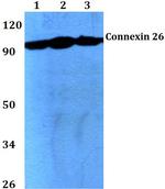 mGluR2/mGluR3 Antibody in Western Blot (WB)