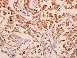 mGluR2/mGluR3 Antibody in Immunohistochemistry (Paraffin) (IHC (P))