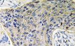 Aquaporin 4 Antibody in Immunohistochemistry (Paraffin) (IHC (P))