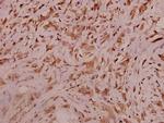 Sodium Channel Pan Antibody in Immunohistochemistry (Paraffin) (IHC (P))