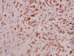 IL-11 Antibody in Immunohistochemistry (Paraffin) (IHC (P))