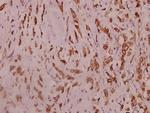 SCN2A Antibody in Immunohistochemistry (Paraffin) (IHC (P))