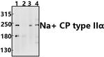 SCN2A Antibody in Western Blot (WB)