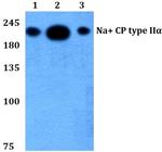 SCN2A Antibody in Western Blot (WB)