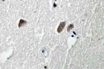 CaMKII beta/gamma/delta Antibody in Immunohistochemistry (Paraffin) (IHC (P))