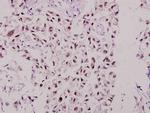 MSK1 Antibody in Immunohistochemistry (Paraffin) (IHC (P))