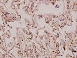 MRPS9 Antibody in Immunohistochemistry (Paraffin) (IHC (P))