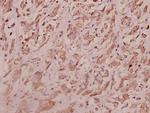 RPL7 Antibody in Immunohistochemistry (Paraffin) (IHC (P))